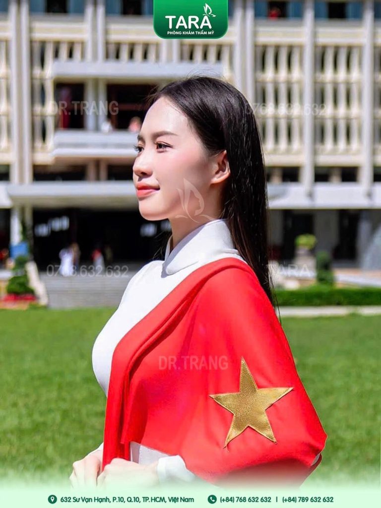 Khi nào cần sửa mũi sau nâng mũi không nẹp? Dấu hiệu nhận biết & mốc thời gian phù hợp