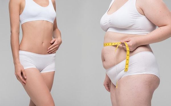 Tạo hình thành bụng cho mẹ bỉm: xử lý da thừa, rạn và cơ bụng tách sau sinh